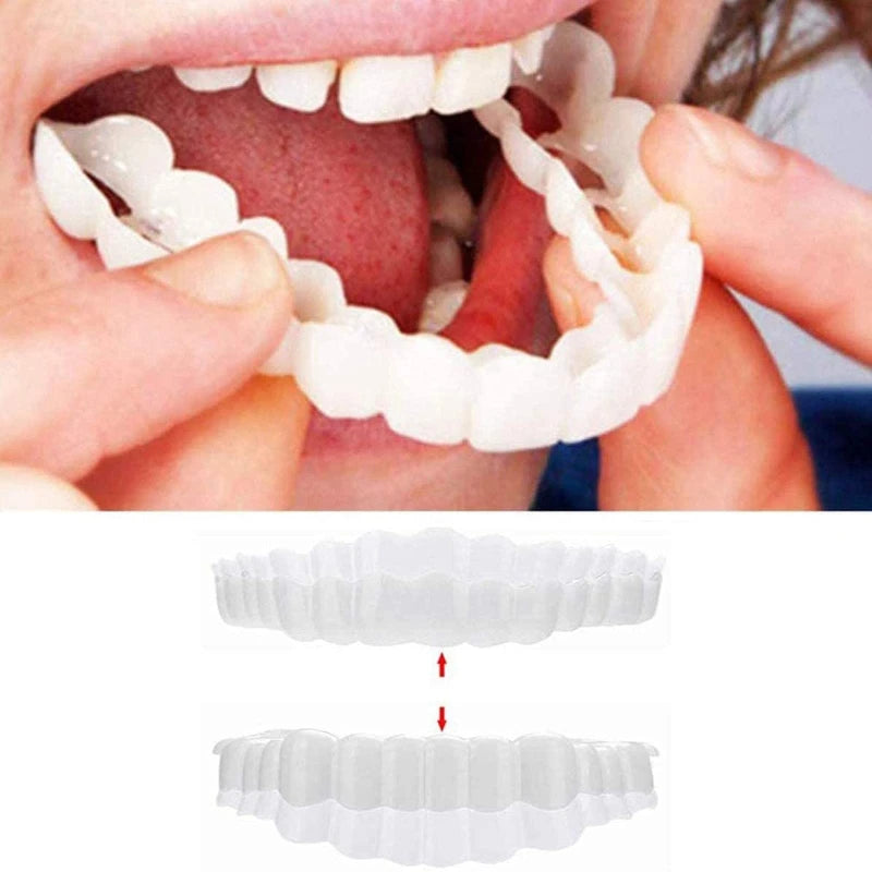 Facetas Odontológicas Removíveis | Sorriso Perfeito
