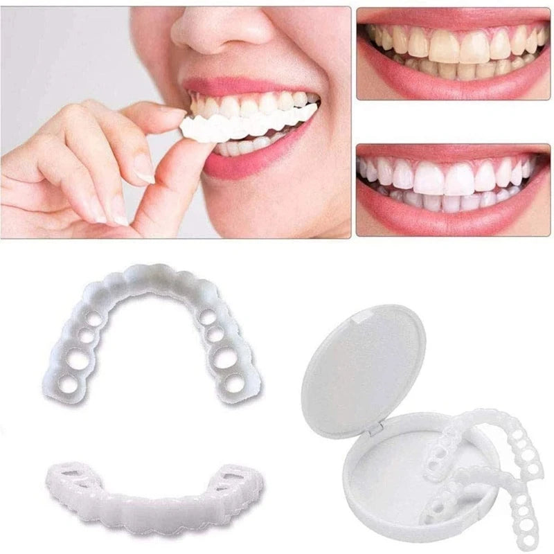 Facetas Odontológicas Removíveis | Sorriso Perfeito
