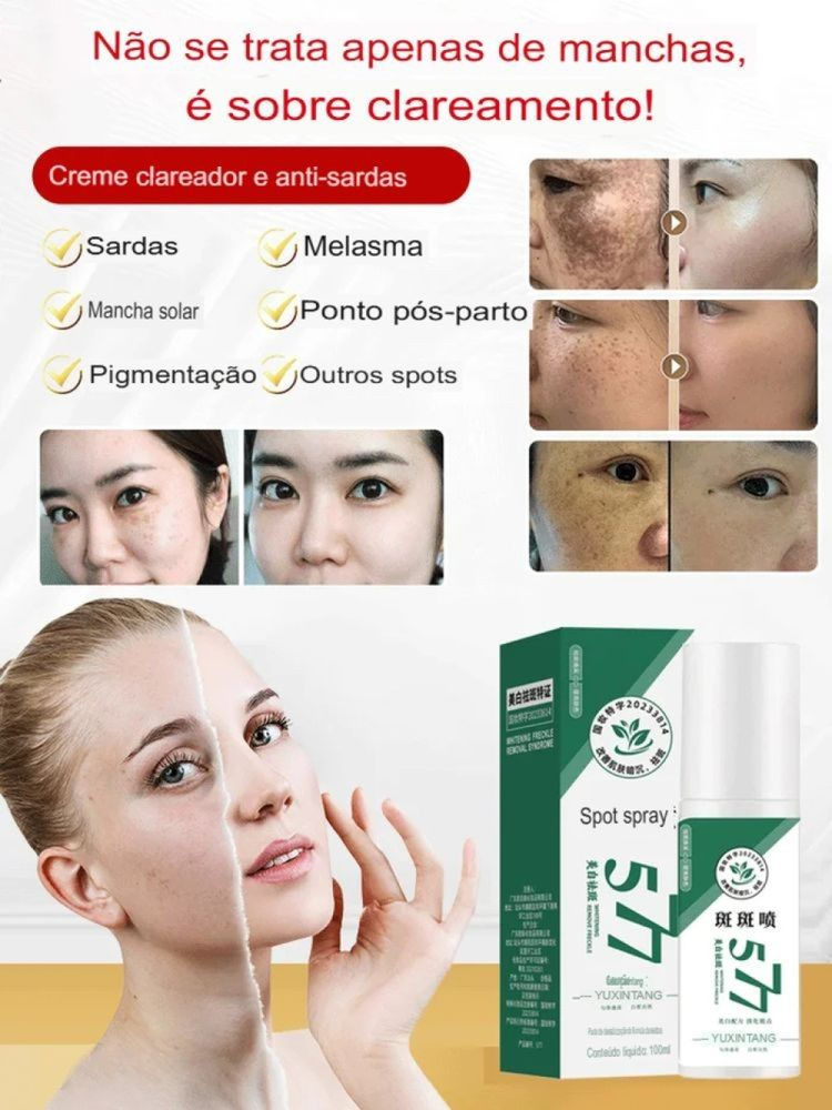 577-Spray Remove manchas de SOL, IDADE E MELASMA! 50% DE DESCONTO + FRETE GRÁTIS!