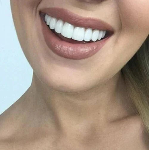 Facetas Odontológicas Removíveis | Sorriso Perfeito