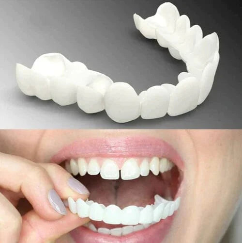 Facetas Odontológicas Removíveis | Sorriso Perfeito