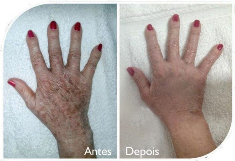 Máscara para as Mãos - RtopR - Acaba com manchas de idade. 50% DE DESCONTO + FRETE GRÁTIS